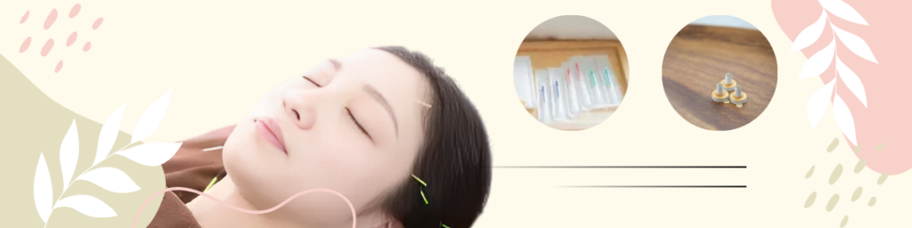 鍼灸用品（鍼、灸）<br /><br />
出雲市　美容鍼・鍼灸整体mahaRE;で美容鍼をしているお客さまの写真